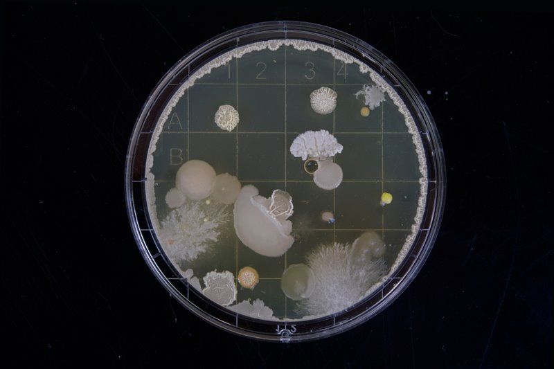 Próbka z bakteriami Photo by Michael Schiffer on Unsplash